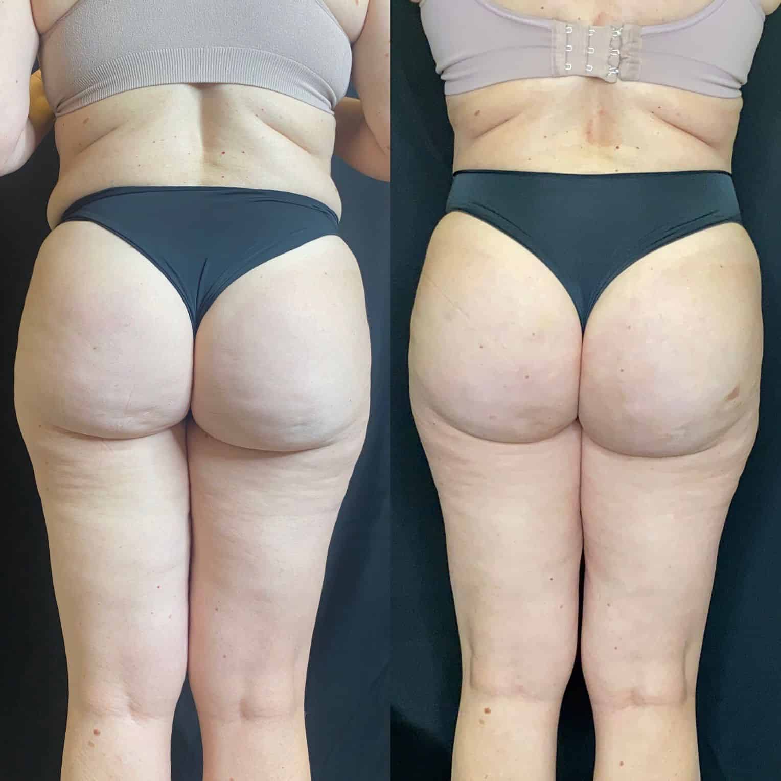 Clínica Vitaliza - Beleza - Estetica - em Barretos (5)