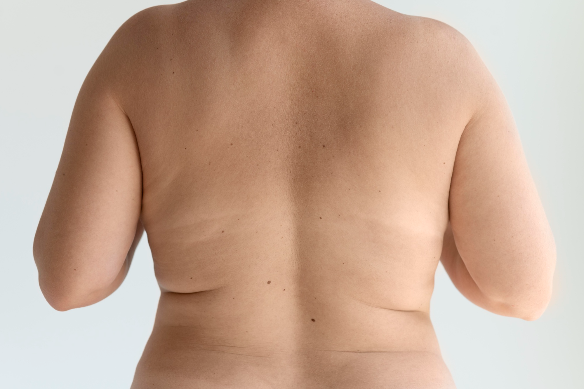 Mini Lipo em Barretos