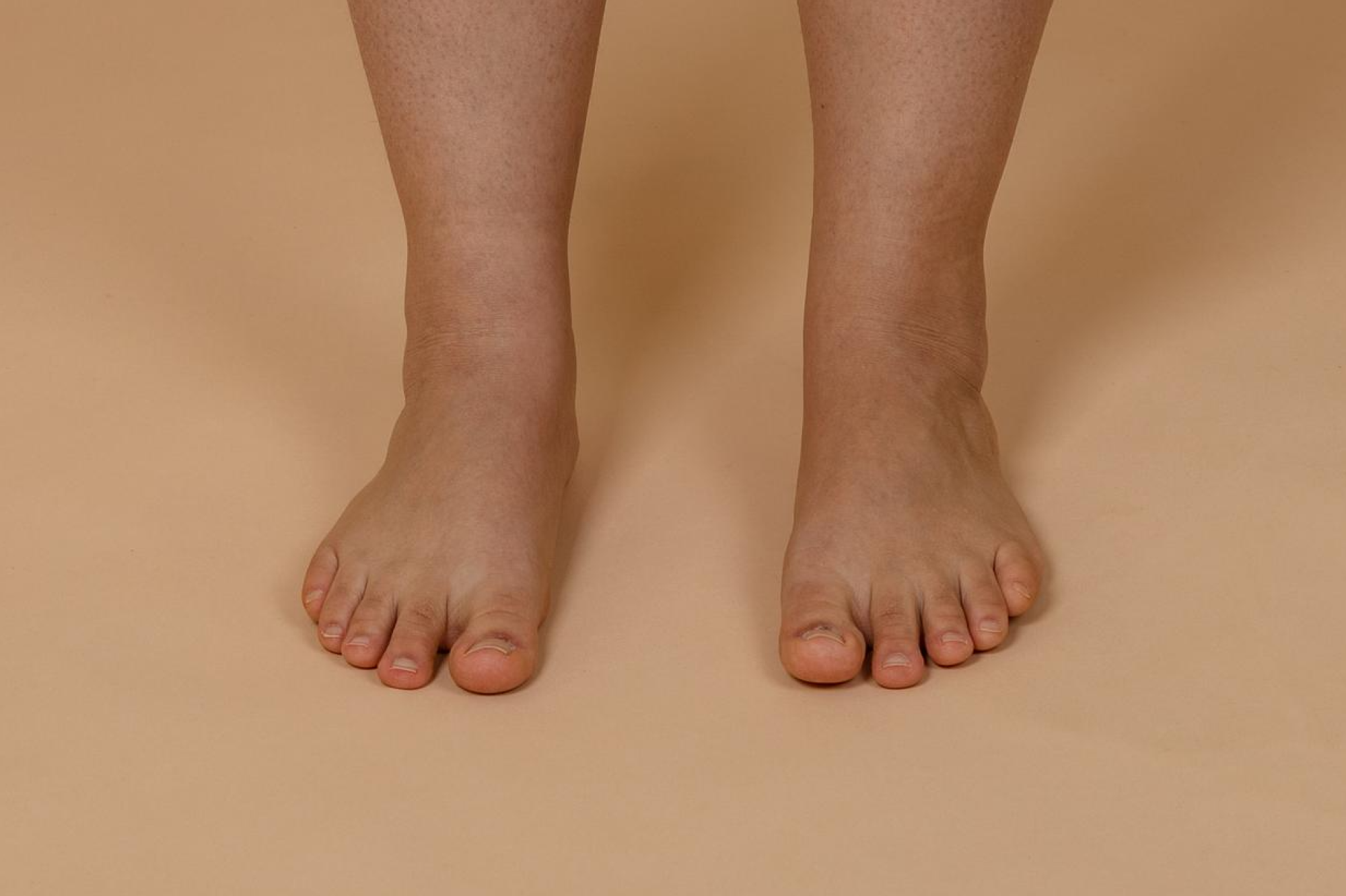 Mini Lipo em Barretos