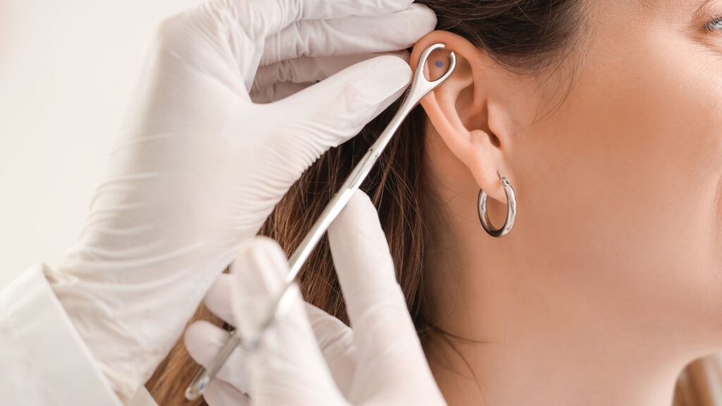 Otomodelação de Orelha: O que é, Como Funciona e Quanto Custa Clínica Vitaliza | Estética, Beleza e Saúde Otomodelação de Orelha: O que é