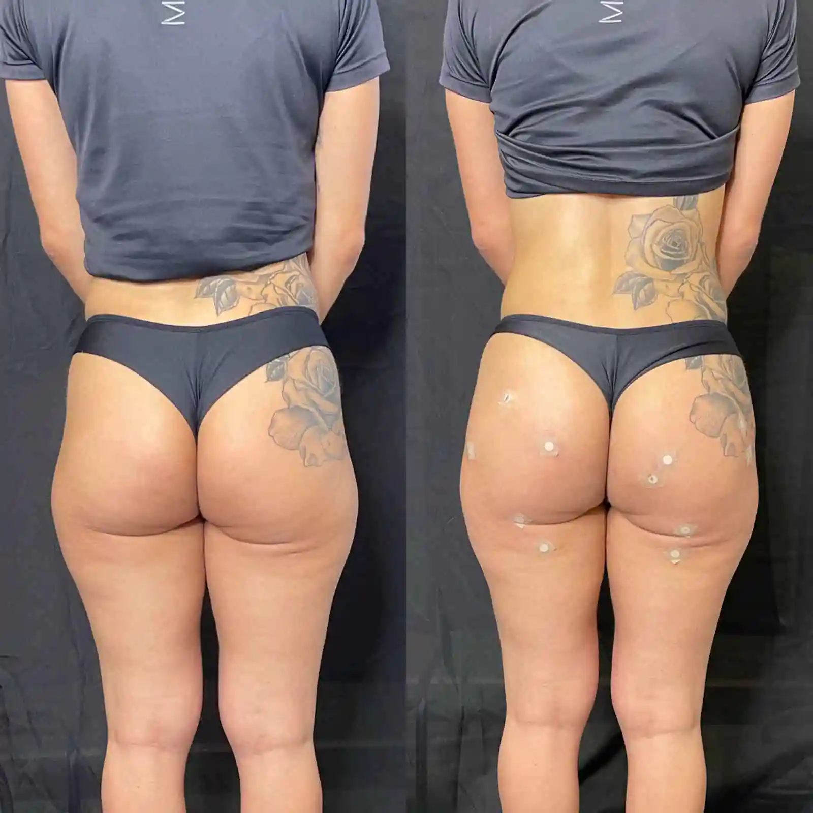 Clínica Vitaliza - Beleza - Estetica - em Barretos (15)