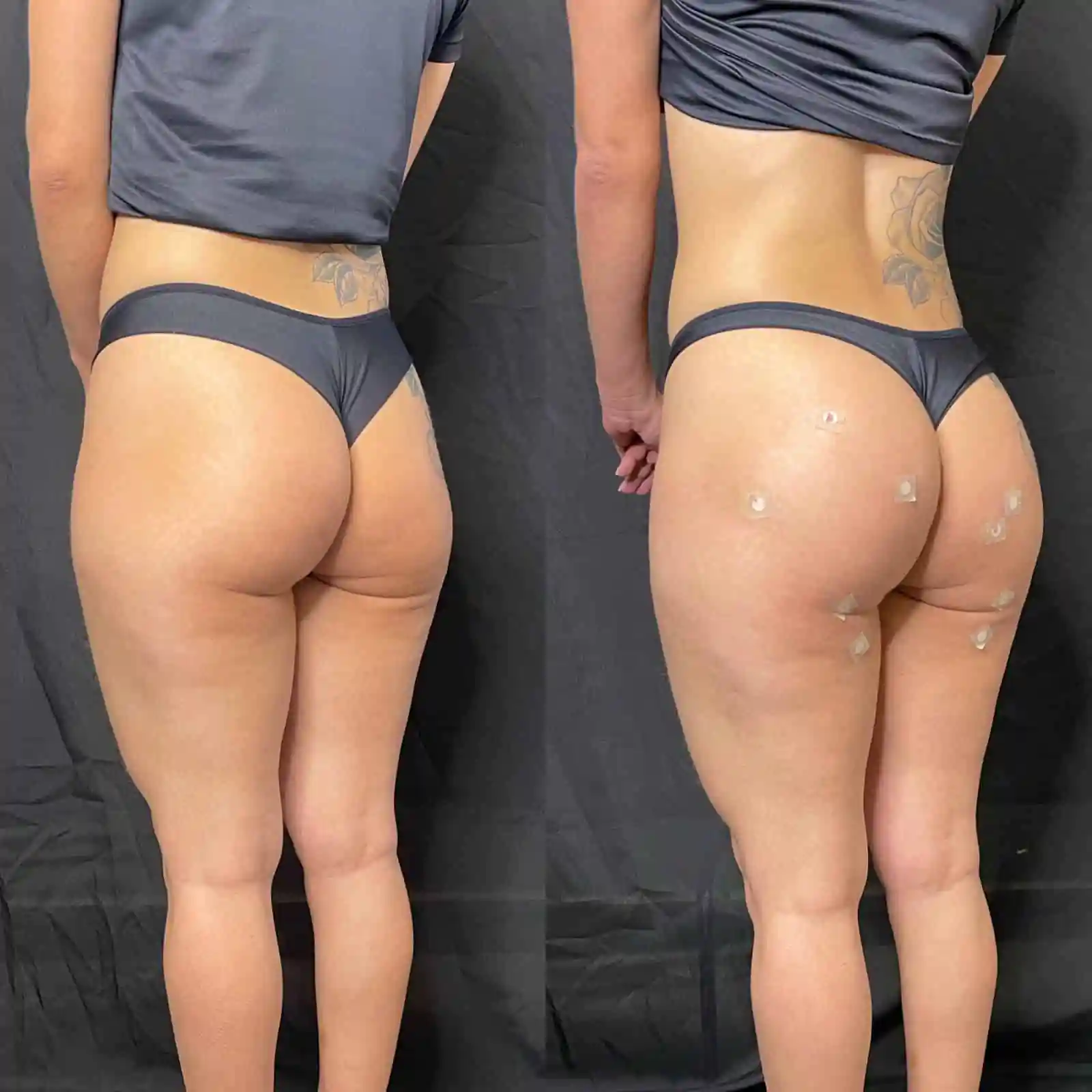 Clínica Vitaliza - Beleza - Estetica - em Barretos (17)