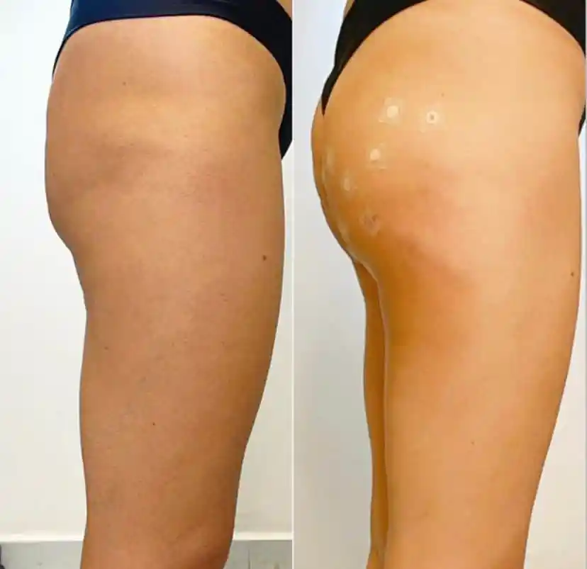 Clínica Vitaliza - Beleza - Estetica - em Barretos (19)